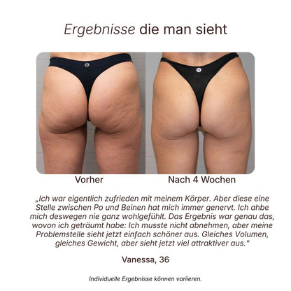 WAUSKIN LumaSculpt